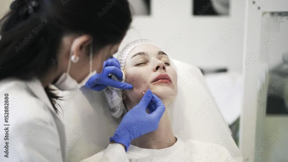 Cosmetician inserting needles under the skin of a woman lying in bed. Handheld real time medium shot Cosmetician inserting needles under the skin of a woman lying in bed. Handheld real time medium shot
