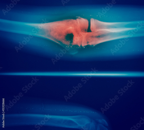 Close up bone  x-ray © toeytoey