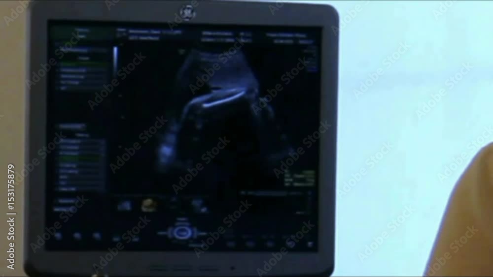 Doctor Making Ultrasound of a Pregnant Woman Doctor Making Ultrasound of a Pregnant Woman