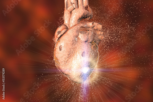 Destruction of heart. Heart disease concept, 3D illustration photo