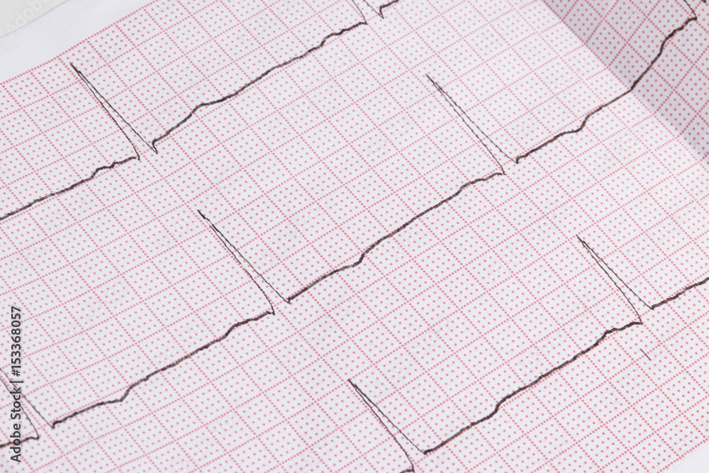 Close up of an electrocardiogram in paper form, medical healthcare