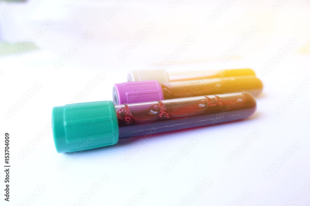 Hand with latex glove holding blood sample Hand with latex glove holding blood sample