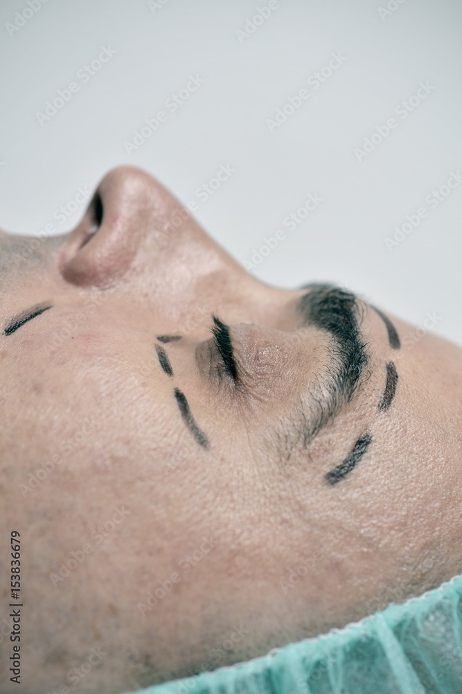 man about to have a plastic surgery man about to have a plastic surgery