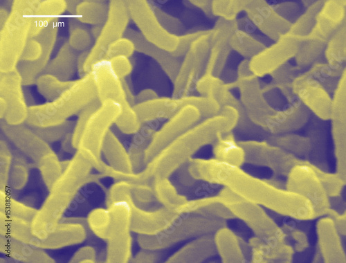 Scanning electron micrograph of Cholera bacteria photo