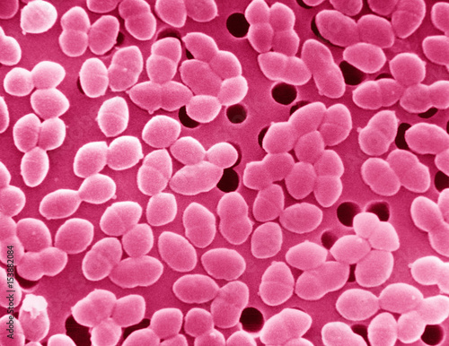 SEM of Gram-positive Enterococcus bacteria photo