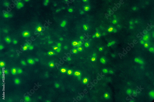 Electron micrograph of Haemophilus influenzae photo