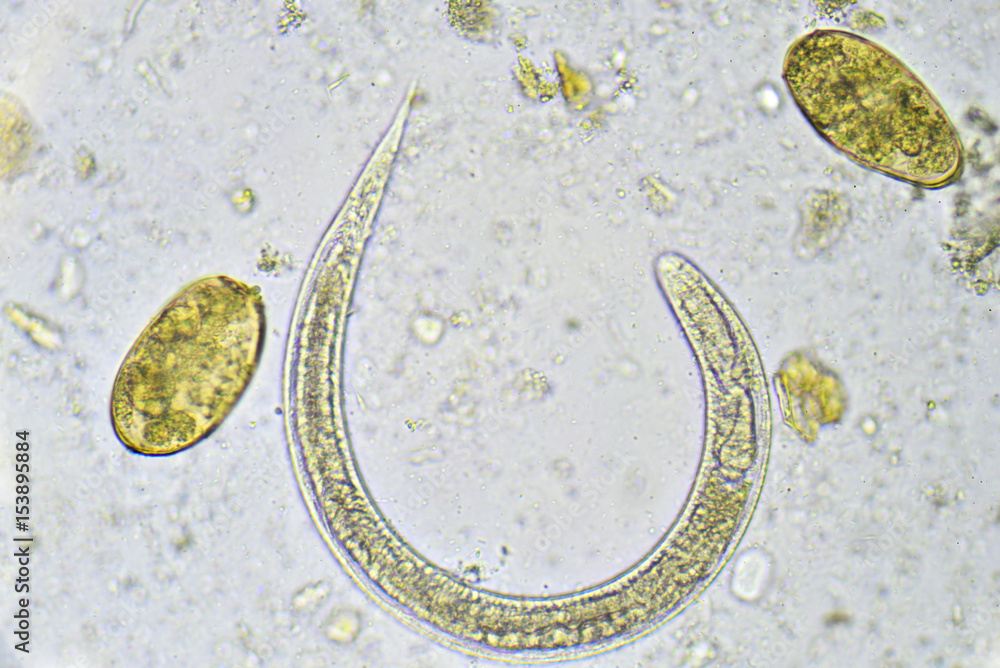 Fotografia Do Stock Strongyloides Stercoralis And Eggs Of Helminth In Fotografia Do Stock Strongyloides Stercoralis And Eggs Of Helminth In