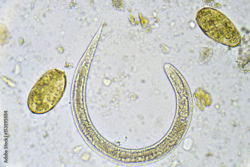 Strongyloides stercoralis and eggs of helminth in stool, analyze by microscope photo
