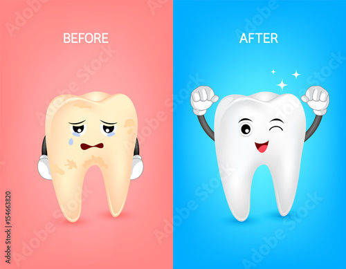 Cartoon tooth character before and after. Whiten yellow teeth. Dental care concept,  illustration.