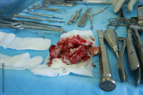 Принти на полотні Bunch of removed diseased jaw bones with teeth inside lie on a gauze at surgical