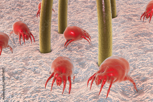 Dust mites Dermatophagoides on human skin with hairs, parasites which live in dust and furniture and whose excrements cause allergic reaction and asthma, 3D illustration photo