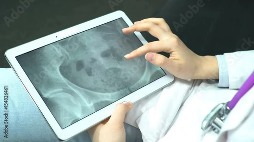 Doctor Sits in the Office She Use Tablet Computer and Controlling Patient X-Ray 