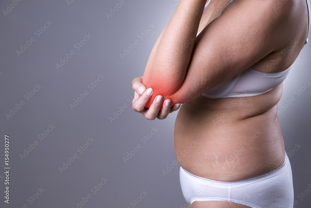 Leg pain, fat woman with muscle ache, overweight female body isolated