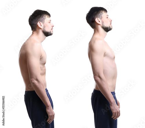 Rehabilitation concept. Col...