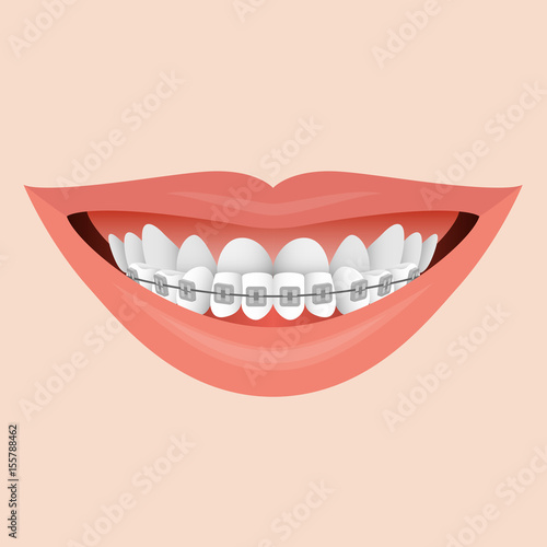 Smile with Braces