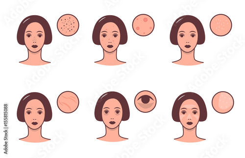 Set of female faces with various skin conditions and problem. Skincare and dermatology concept. Vector colorful illustration.