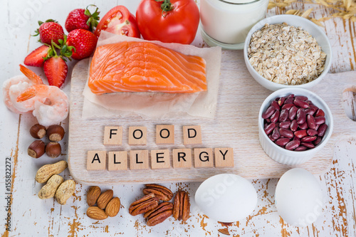 Food allergies - food concept with major allergens photo
