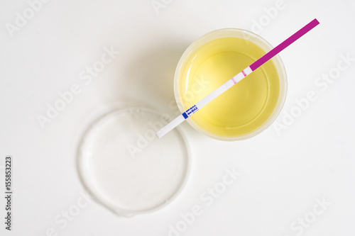 Methamphetamine Test of urine for health check photo