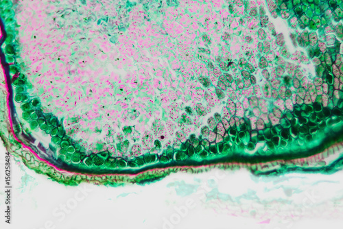 Cell caryopsis rye- biotechnology tissue