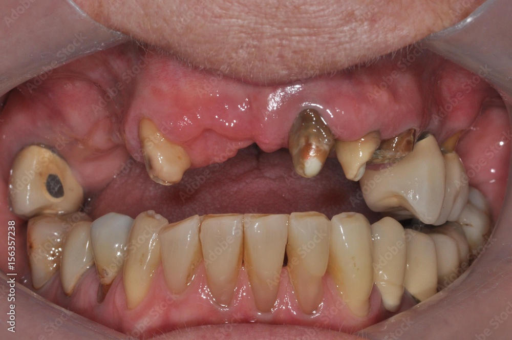 Initial Dental Treatment