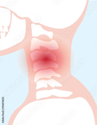 vector background of neck bone injured