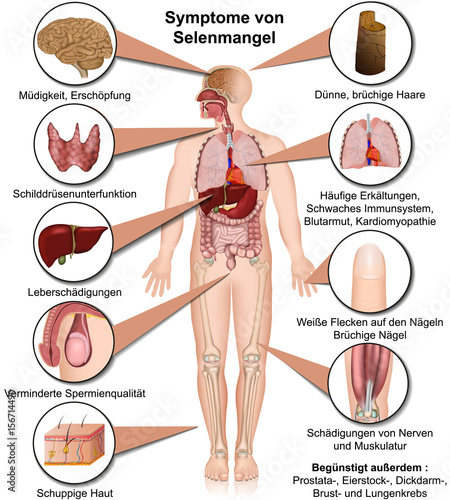 Symptome des menschlichen Körpers bei Selenmangel