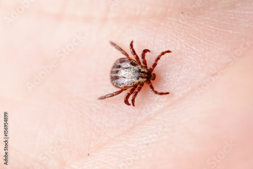 Forest mite on the skin. wood tick photo