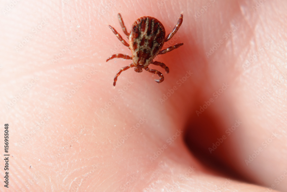 Forest mite on the skin. wood tick Forest mite on the skin. wood tick