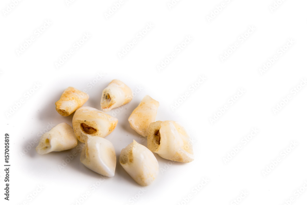 Collection of extracted milk teeth