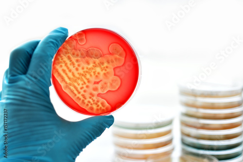 Colonies of bacteria in blood agar (culture medium plate)
 photo