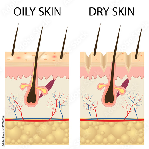 Dry and oily skin.
