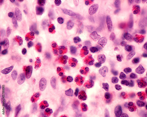Eosinophil granulocytes photo
