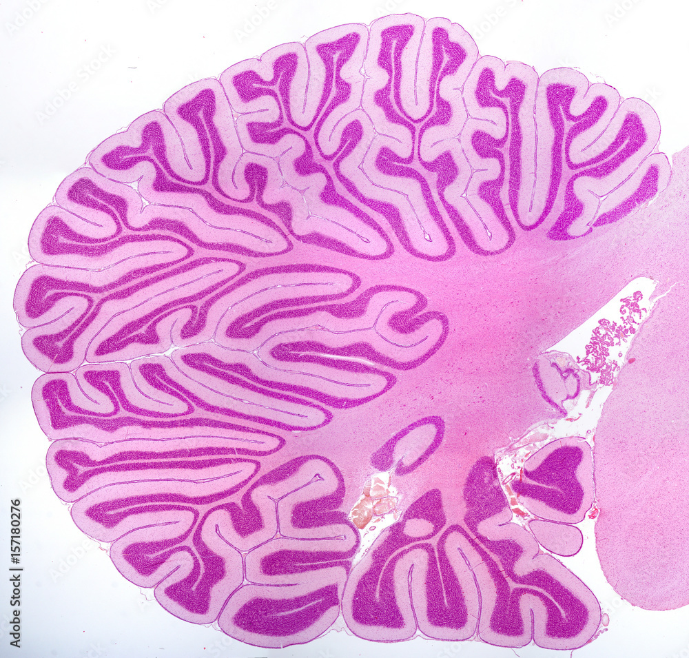 Foto Cerebellum. Sagittal section