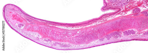 Human epiglottis photo