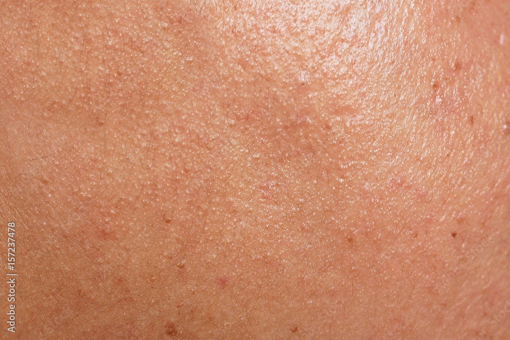 Fototapeta premium Human skin texture