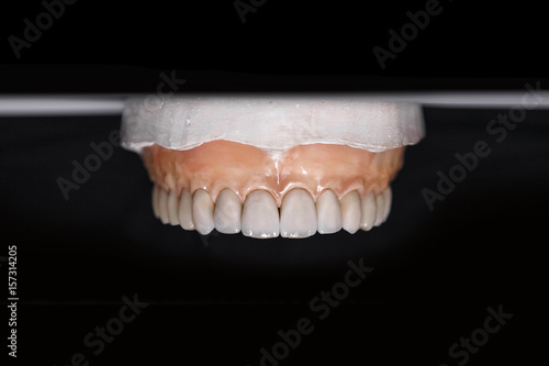 Ceramic teeth dental crowns on model, metal free - front view . Ceramic front veneers isolated on black background. Metal-Ceramic crowns on gypsum model in dental laboratory.