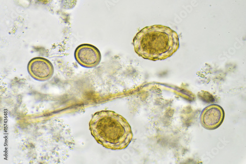 Eggs of helminthes in stool, analyze by microscope photo