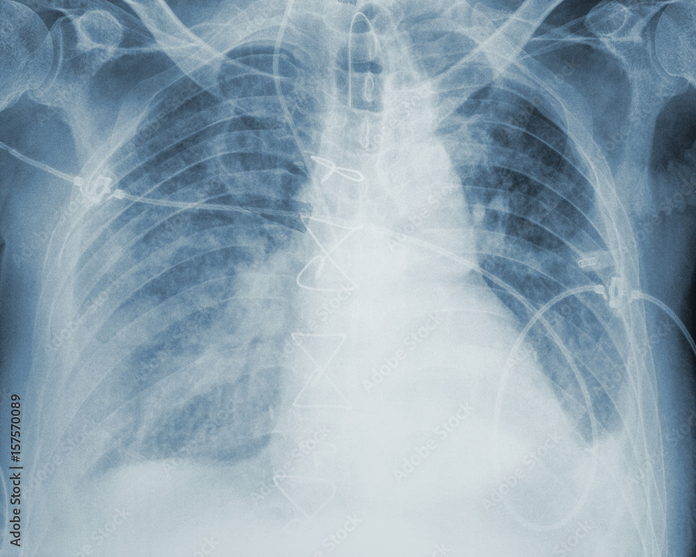 Fotografie Image of an X-ray analysis