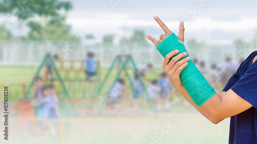 green cast on hand and arm on blurred background student playing with toy on playground in the school