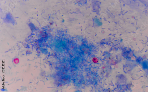 red cells cryptosporidium oocyte photo