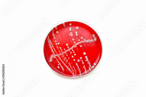 Colonies of bacteria in petri dish (blood agar)
 photo