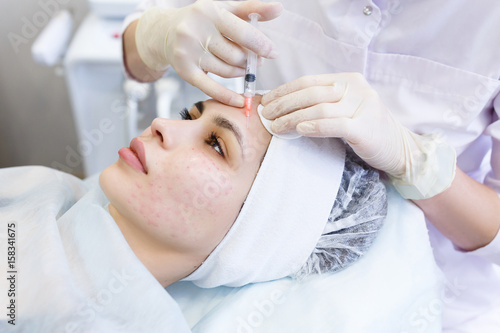 Tableau sur toile Needle mesotherapy. Cosmetic been injected woman's face