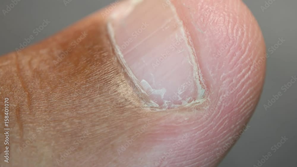 Close up of Human Skin Texture
Close up of Human Skin Texture