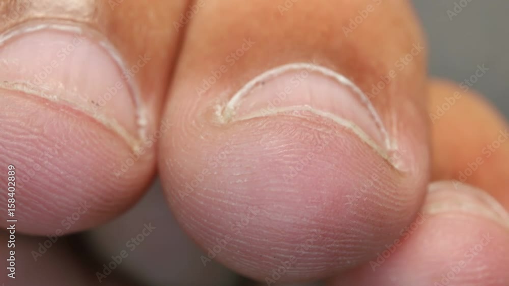 Close up of Human Skin Texture
Close up of Human Skin Texture
