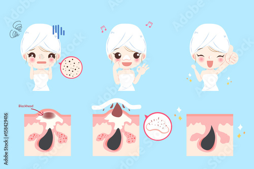 woman with acne problem