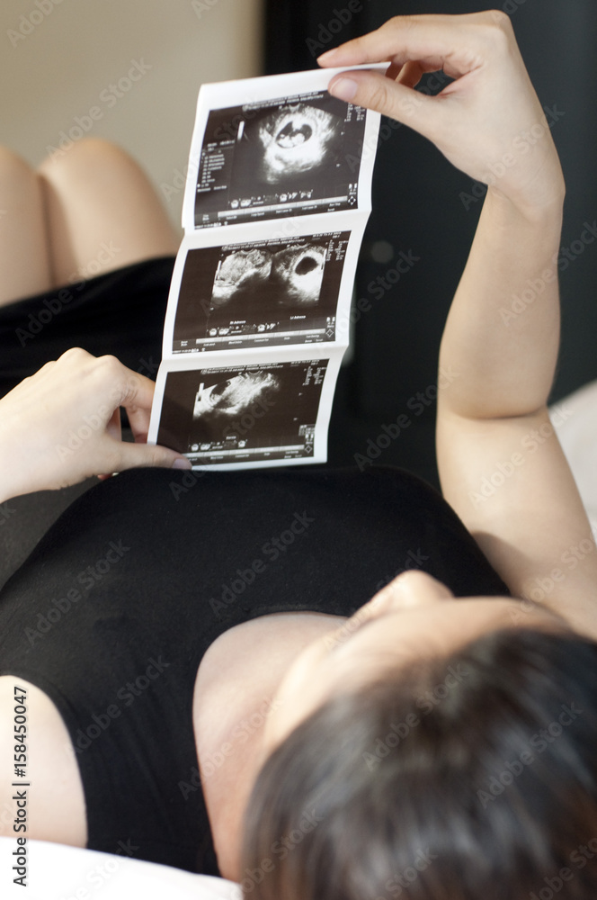 A pregnant woman wearing a black dress is holding a sonogram A pregnant woman wearing a black dress is holding a sonogram