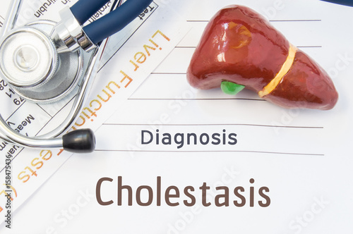 Canvastavla Cholestasis diagnosis