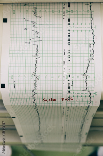 Fetal monitoring