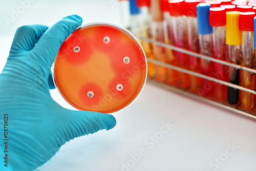 Antimicrobial susceptibility testing in petri dish
 photo