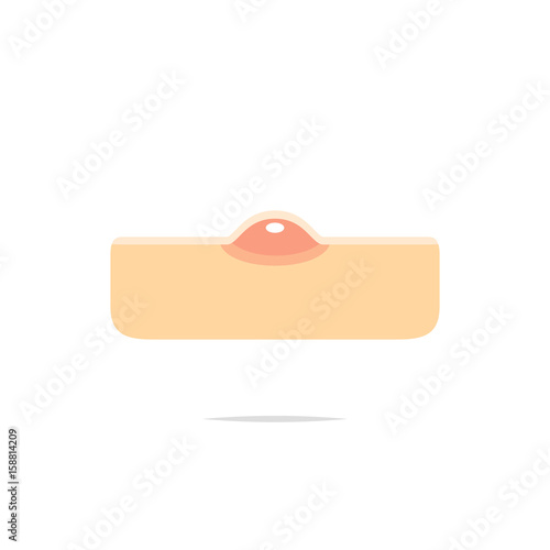 Pimple acne icon vector illustration